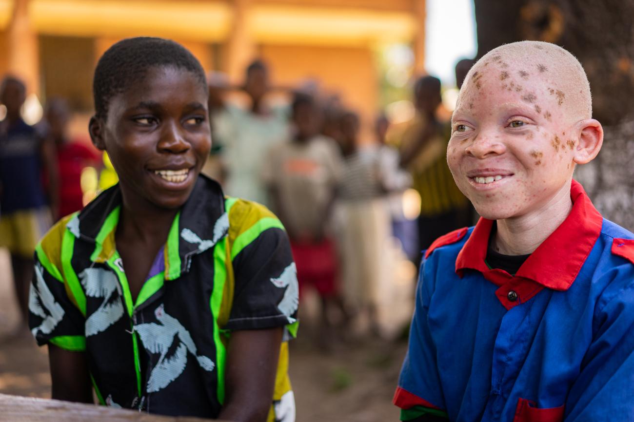 Chinsisi Jafali, a 14-year-old with albinism in Malawi